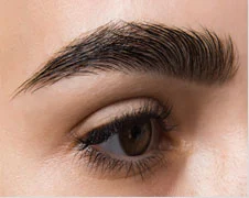 brow-restoration